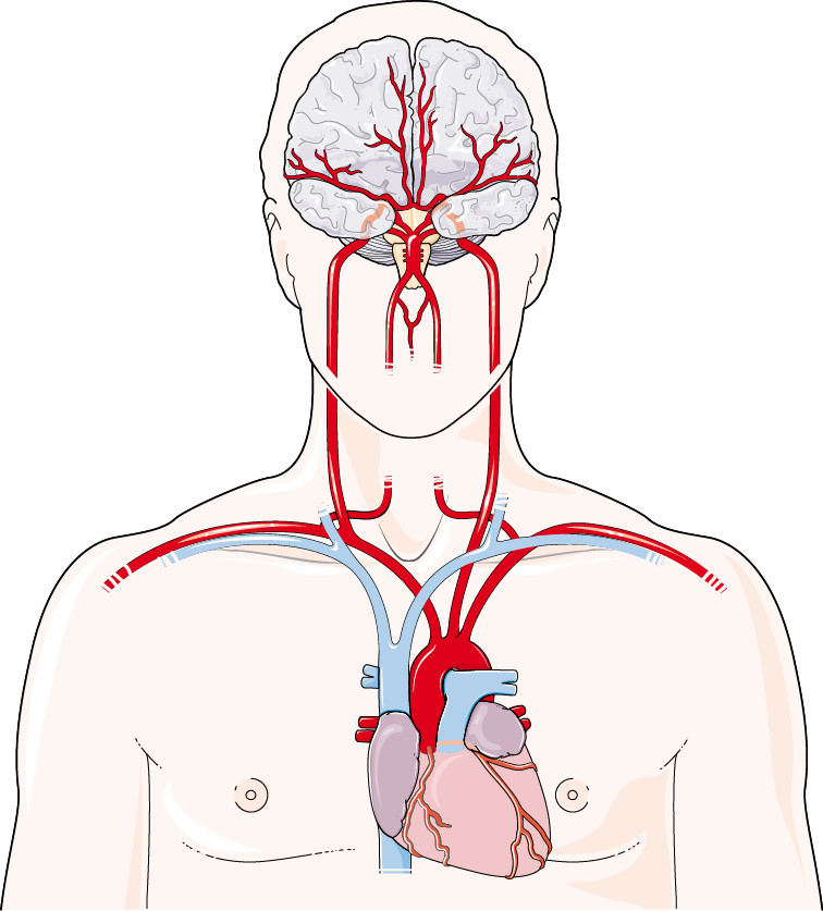 Brain arteries. Courtesy of Servier Medical art, CC attribution 3.0 license